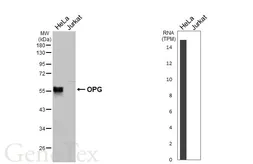 Anti-OPG antibody [HL3377] used in Western Blot (WB). GTX641197