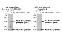 Anti-PDGF Receptor beta (phospho Tyr751) antibody [HL3385] used in Western Blot (WB). GTX641205