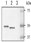 Anti-NADase antibody used in Western Blot (WB). GTX64140