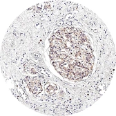Anti-Somatostatin receptor 3 antibody [H340] HistoMAX&trade; used in IHC (Paraffin sections) (IHC-P). GTX641401