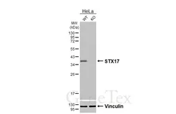 Anti-STX17 antibody [HL3534] used in Western Blot (WB). GTX641431