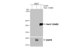 Anti-Her2 / ErbB2 antibody [HL3566] used in Western Blot (WB). GTX641472