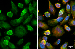 Anti-beta 2 Adrenergic Receptor antibody [HL3594] used in Immunocytochemistry/ Immunofluorescence (ICC/IF). GTX641565