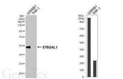 Anti-ST6GAL1 antibody [HL3611] used in Western Blot (WB). GTX641586