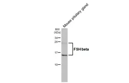 Anti-FSH beta antibody [GT64] used in Western Blot (WB). GTX641602