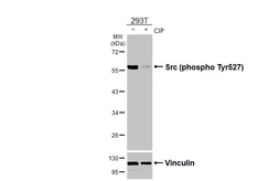 Anti-Src (phospho Tyr530) antibody [HL3645] used in Western Blot (WB). GTX641636