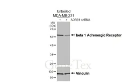 Anti-beta 1 Adrenergic Receptor antibody [HL3678] used in Western Blot (WB). GTX641706