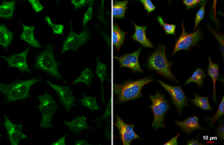 Anti-GALNT2 antibody [HL3746] used in Immunocytochemistry/ Immunofluorescence (ICC/IF). GTX641945