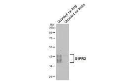 Anti-S1PR2 antibody [HL3765] used in Western Blot (WB). GTX641964