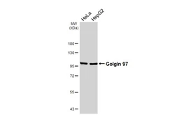 Anti-Golgin 97 antibody [HL3788] used in Western Blot (WB). GTX642007
