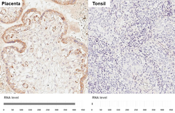 Anti-VEGF Receptor 1 antibody [HL3799] used in IHC (Paraffin sections) (IHC-P). GTX642018