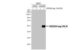 Anti-CRLR antibody [HL3876] used in Western Blot (WB). GTX642114