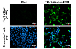 Anti-TRAF6 antibody [HL3886] used in Immunocytochemistry/ Immunofluorescence (ICC/IF). GTX642127