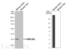 Anti-HAPLN2 antibody [GT107] used in Western Blot (WB). GTX642155