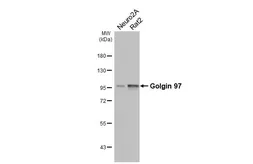 Anti-Golgin 97 antibody [HL3913] used in Western Blot (WB). GTX642158