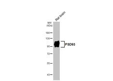 Anti-PSD93 antibody [GT126] used in Western Blot (WB). GTX642326