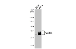 Anti-Paxillin antibody [HL4001] used in Western Blot (WB). GTX642332