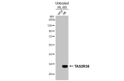 Anti-TAS2R38 antibody [HL4024] used in Western Blot (WB). GTX642355