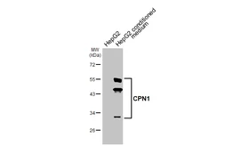 Anti-CPN1 antibody [HL4040] used in Western Blot (WB). GTX642455