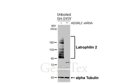 Anti-Latrophilin 2 antibody [HL4090] used in Western Blot (WB). GTX642529