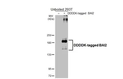Anti-BAI2 antibody [HL4093] used in Western Blot (WB). GTX642532