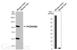 Anti-PCDHGB2 antibody [GT156] used in Western Blot (WB). GTX642583