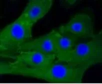 Anti-Caldesmon antibody [GT1108] used in Immunocytochemistry/ Immunofluorescence (ICC/IF). GTX64300
