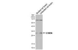 Anti-CSEN antibody [GT177] used in Western Blot (WB). GTX643015