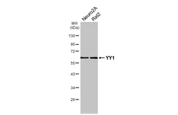 Anti-YY1 antibody [HL4198] used in Western Blot (WB). GTX643021