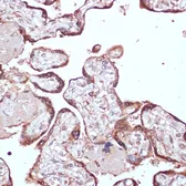 Anti-YAP1 antibody used in IHC (Paraffin sections) (IHC-P). GTX64336