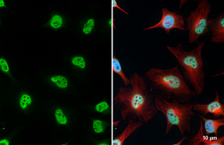 Anti-ALY antibody [HL4253] used in Immunocytochemistry/ Immunofluorescence (ICC/IF). GTX643489