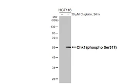 Anti-Chk1 (phospho Ser317) antibody [HL4313] used in Western Blot (WB). GTX643560