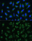 Anti-Apolipoprotein B antibody used in Immunocytochemistry/ Immunofluorescence (ICC/IF). GTX64377