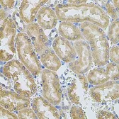 Anti-MMP10 antibody used in IHC (Paraffin sections) (IHC-P). GTX64385
