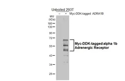 Anti-alpha 1b Adrenergic Receptor antibody [HL4479] used in Western Blot (WB). GTX644046
