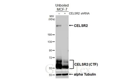 Anti-CELSR2 antibody [HL4484] used in Western Blot (WB). GTX644051