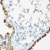 Anti-LRP5 antibody used in IHC (Paraffin sections) (IHC-P). GTX64412