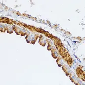 Anti-MLCK antibody used in IHC (Paraffin sections) (IHC-P). GTX64416
