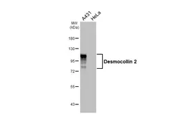 Anti-Desmocollin 2 antibody [HL4655] used in Western Blot (WB). GTX644508