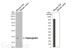 Anti-Haptoglobin antibody [HL4637] used in Western Blot (WB). GTX644510