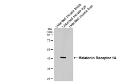Anti-Melatonin Receptor 1A antibody [HL4732] used in Western Blot (WB). GTX644736