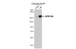 Anti-GPR126 antibody [HL4744] used in Western Blot (WB). GTX644748