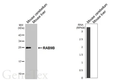 Anti-RAB9B antibody [HL4758] used in Western Blot (WB). GTX644762