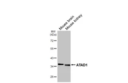 Anti-ATAD1 antibody [GT275] used in Western Blot (WB). GTX644790