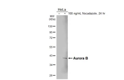 Anti-Aurora B antibody [HL4798] used in Western Blot (WB). GTX644810