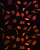 Anti-PHGDH antibody used in Immunocytochemistry/ Immunofluorescence (ICC/IF). GTX64499