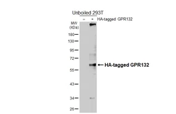 Anti-GPR132 antibody [HL4946] used in Western Blot (WB). GTX645019