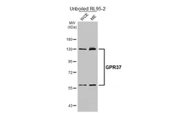 Anti-GPR37 antibody [HL4948] used in Western Blot (WB). GTX645021