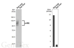 Anti-c-Kit antibody [HL5146] used in Western Blot (WB). GTX645342