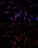 Anti-CPT1B antibody used in Immunocytochemistry/ Immunofluorescence (ICC/IF). GTX64535